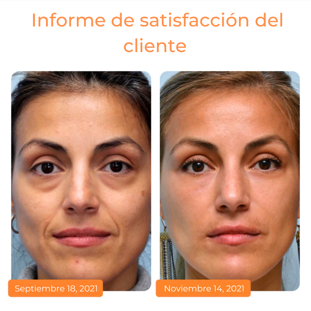 VitaminEyes™ - Parches de colágeno soluble