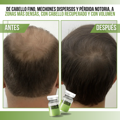 AURIX™ - Revitaliza, fortalece y aumenta tu cabello, día tras día