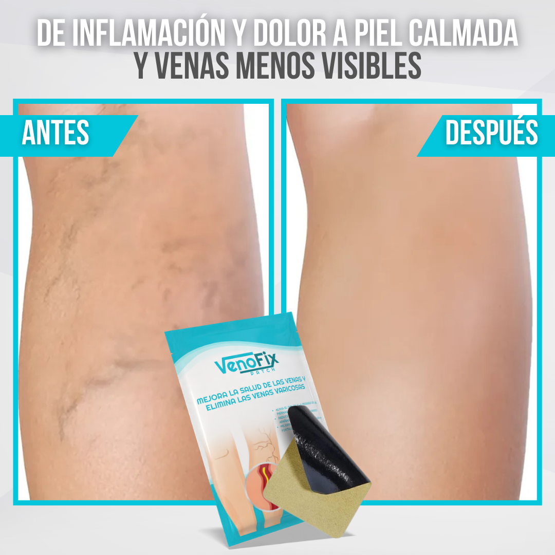 VenoFix Patch™ - Piernas más sanas, venas más fuertes, piel más bella
