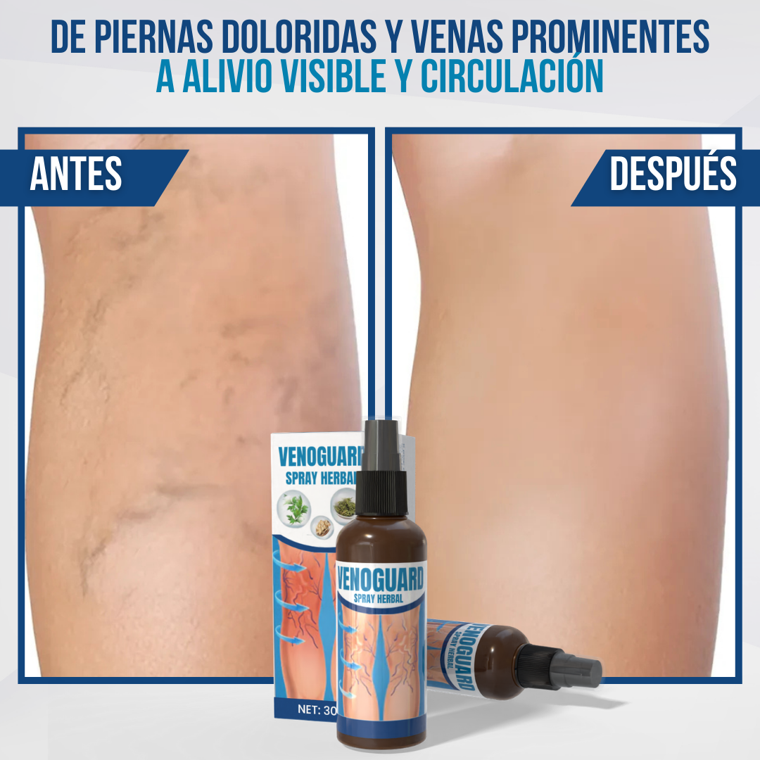 VenoGuard™ - Recupera la salud de tus venas, sin dolor ni cirugía