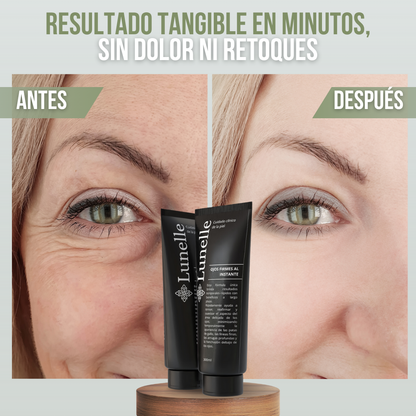 LUNELLE™ - Recupera tu mirada juvenil en minutos