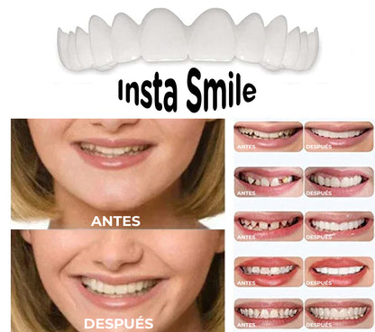 InstaSmile™ - Cubierta de dientes postizos