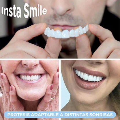 InstaSmile™ - Cubierta de dientes postizos