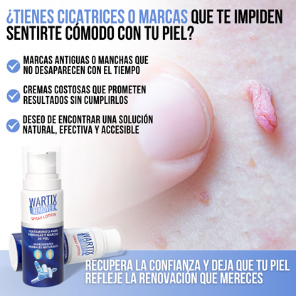 WARTIX REMOVER™ - Elimina verrugas y lunares con suavidad y rapidez