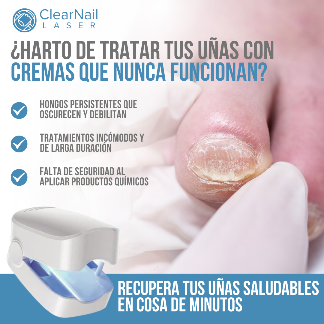 ClearNail Laser™ - Uñas sanas y fuertes desde la primera semana