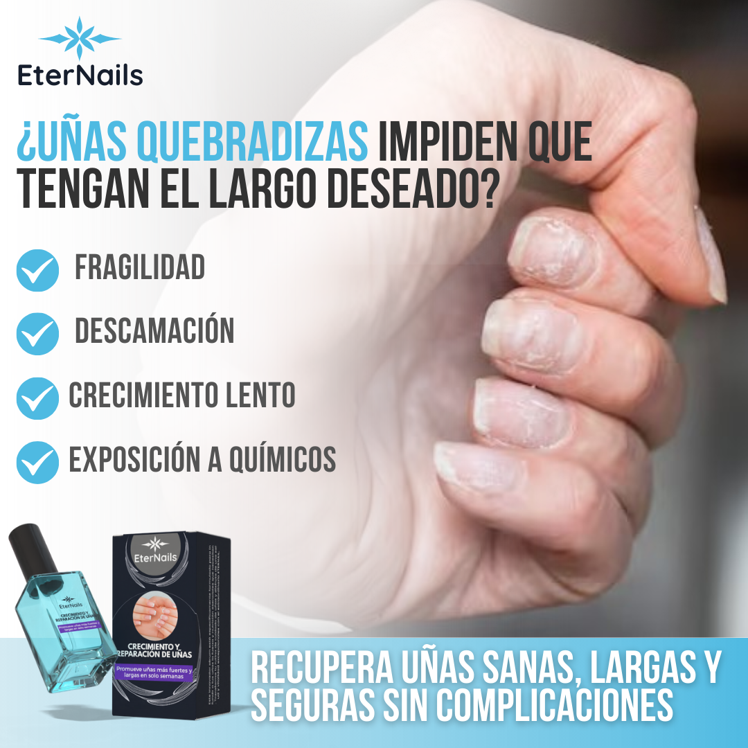 ETERNAIL™ - Uñas más fuertes, sanas y largas desde la primera aplicación