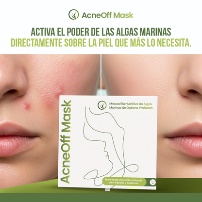 AcneOff Mask™ - Sana tu piel, no la castigues.