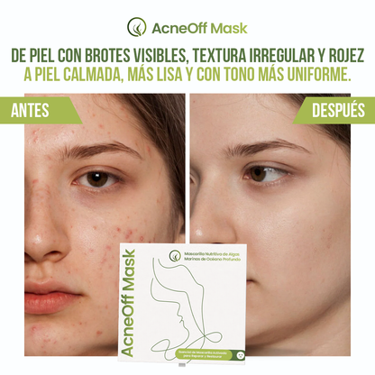 AcneOff Mask™ - Sana tu piel, no la castigues.