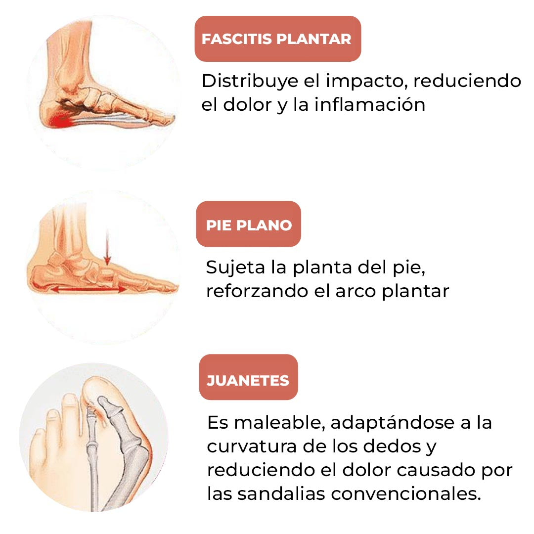 ChillChase™ - Zapatos de invierno para mujeres