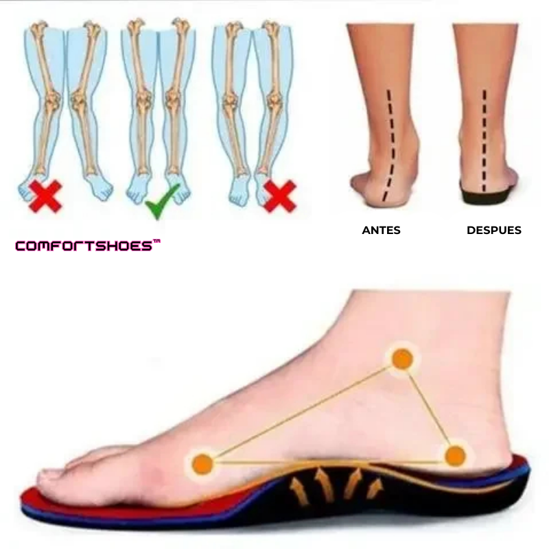 ComfortShoes™ - Zapatos Mocasines Correctivos