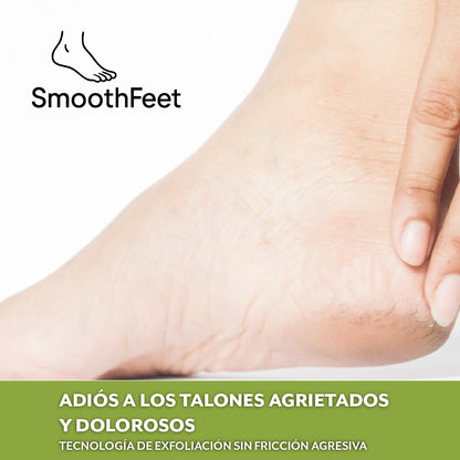 SmoothFeet™ - Dile adiós a los callos