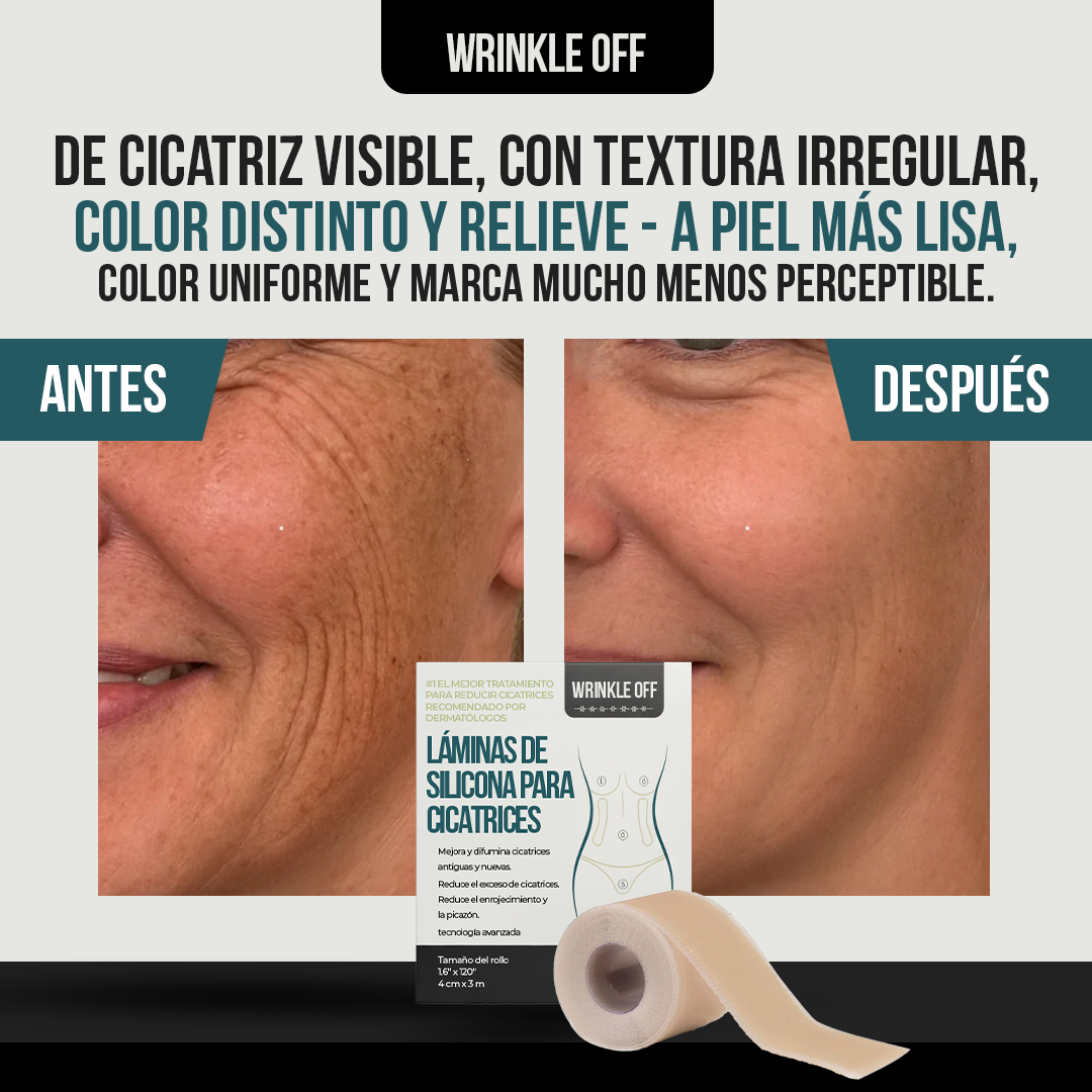 Wrinkle Off™ - Dormir, y despertar con menos arrugas.