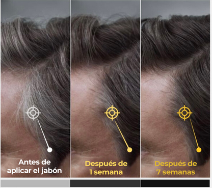 GrayAway™ - Jabón anticanas