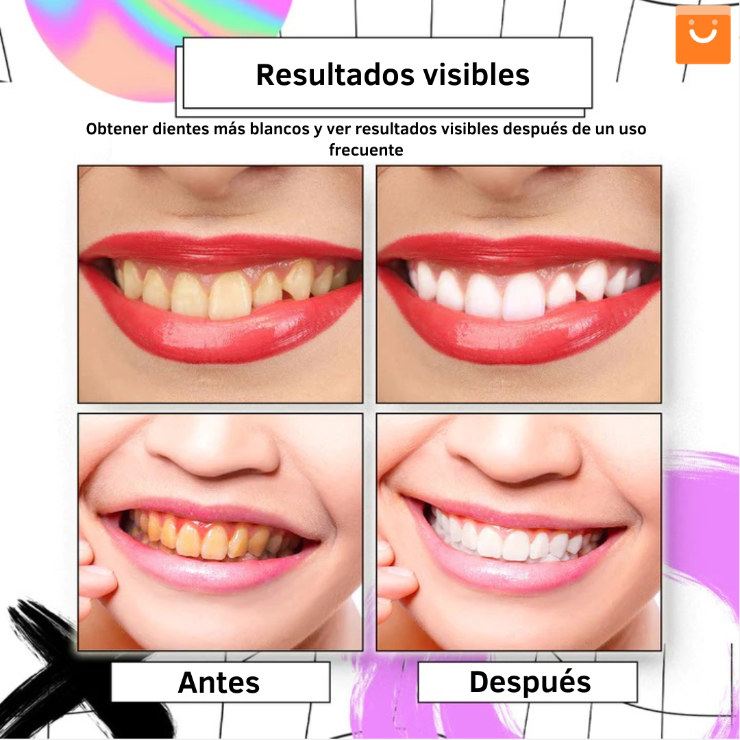 AngelSmile™- Pasta de dientes en mousse morada blanqueadora