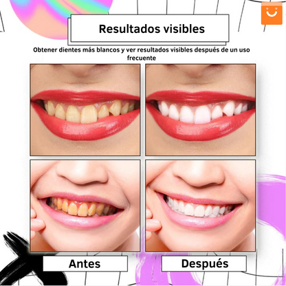 AngelSmile™- Pasta de dientes en mousse morada blanqueadora