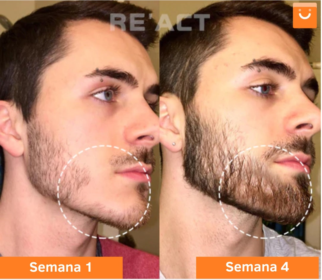 Minoxi™ - tratamiento para el crecimiento del cabello en roll-on