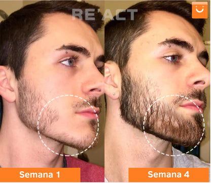 Minoxi™ - tratamiento para el crecimiento del cabello en roll-on