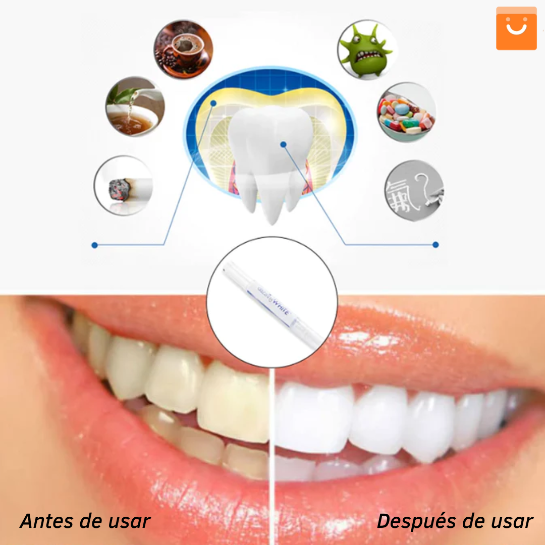 MySmile™ - Bolígrafo blanqueador de dientes (OFERTA  EXCLUSIVA  2 X 1)