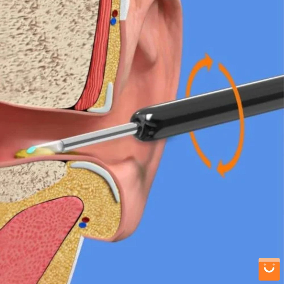 Smartdub™ - Remueve Cera Escondida