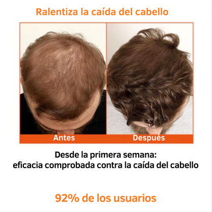 Minoxi™ - tratamiento para el crecimiento del cabello en roll-on